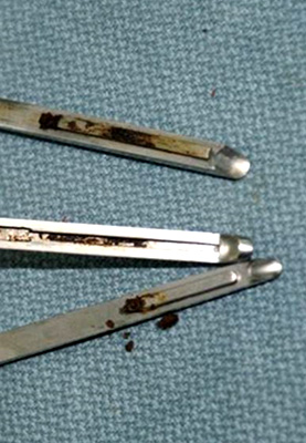 FDA "Greater Risk" Devices 2