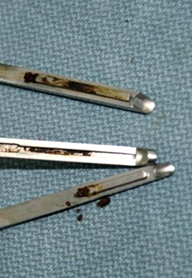 A Little Background on IFUs